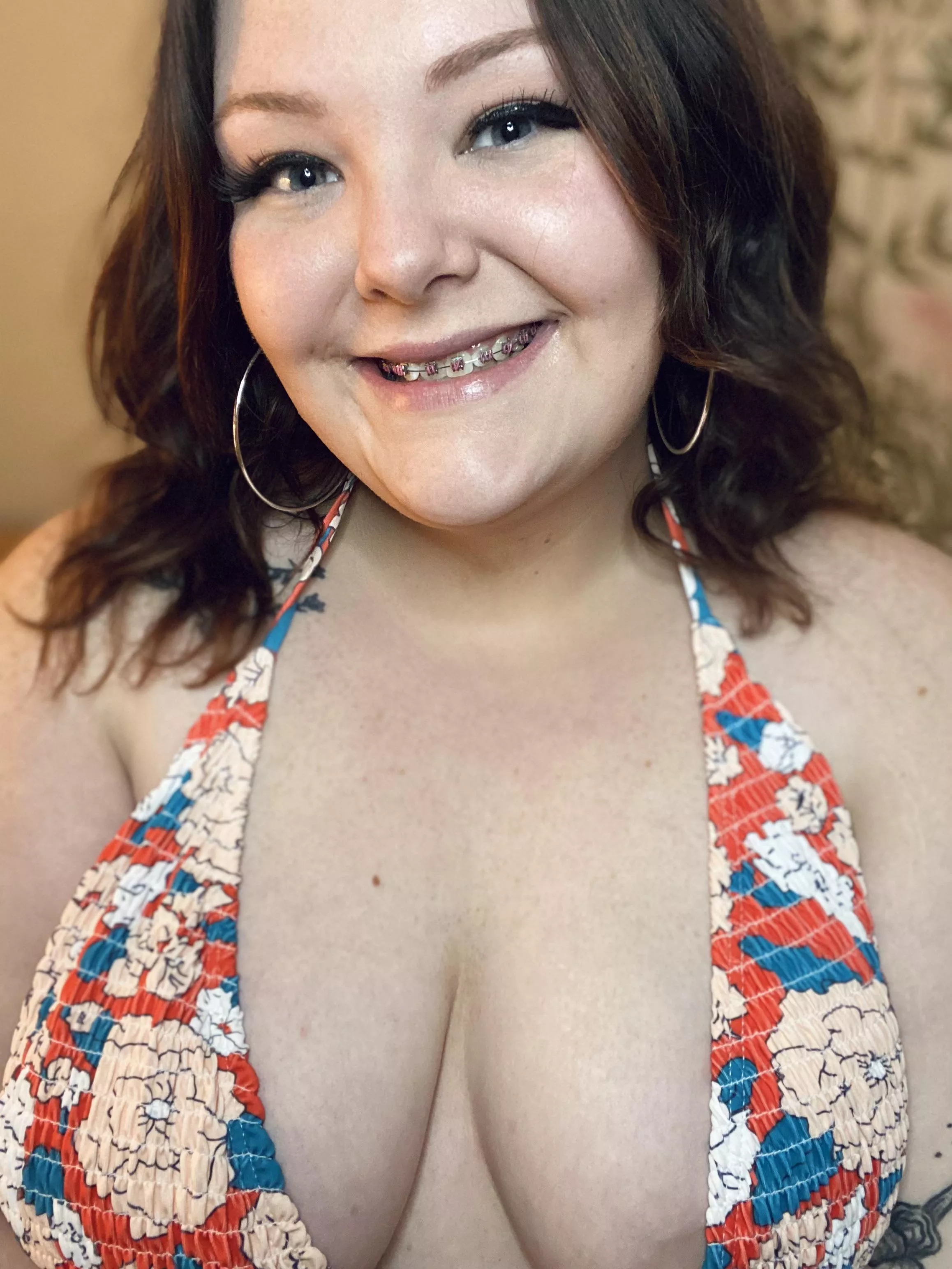BBW brace face 😈