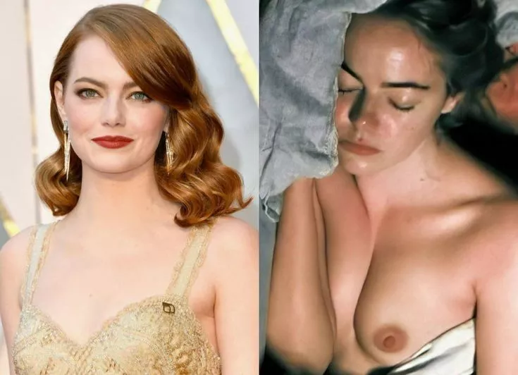 Emma Stone