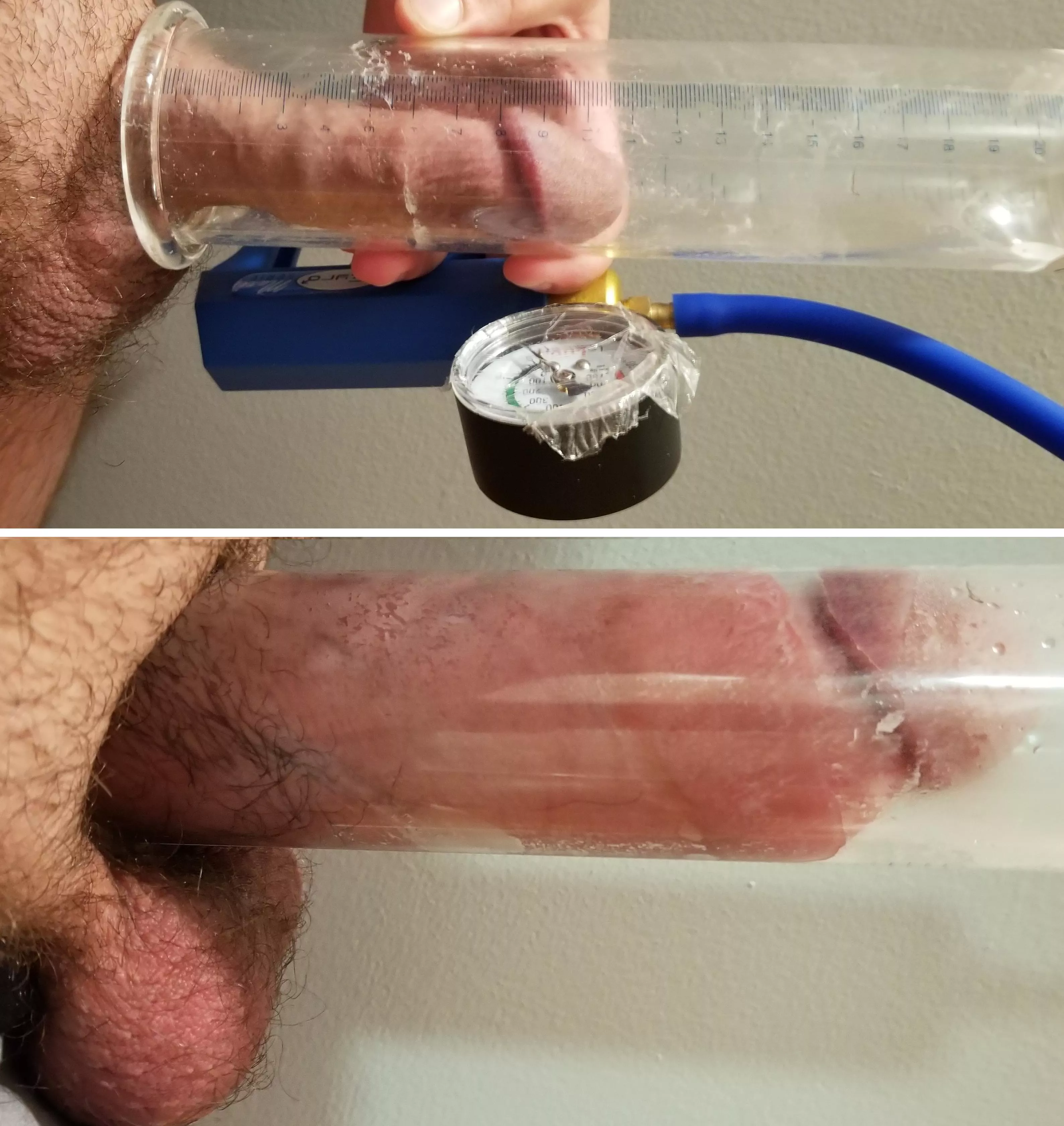11-21cm