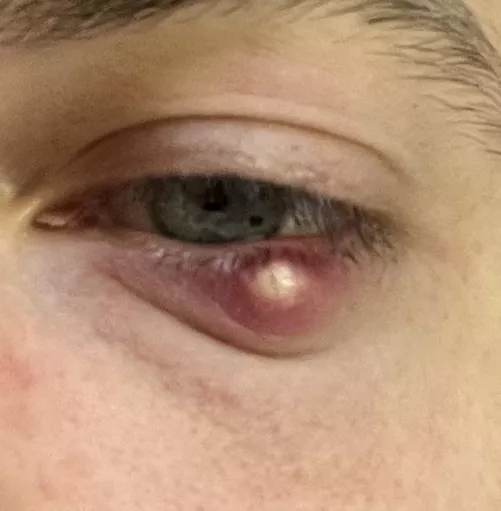 I’m gonna have some nice content for you guys shortly (when it opens naturally)