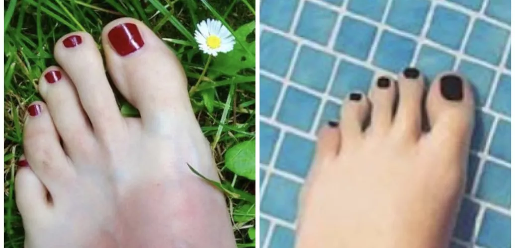 Foot fetish - Which toes you prefer ?