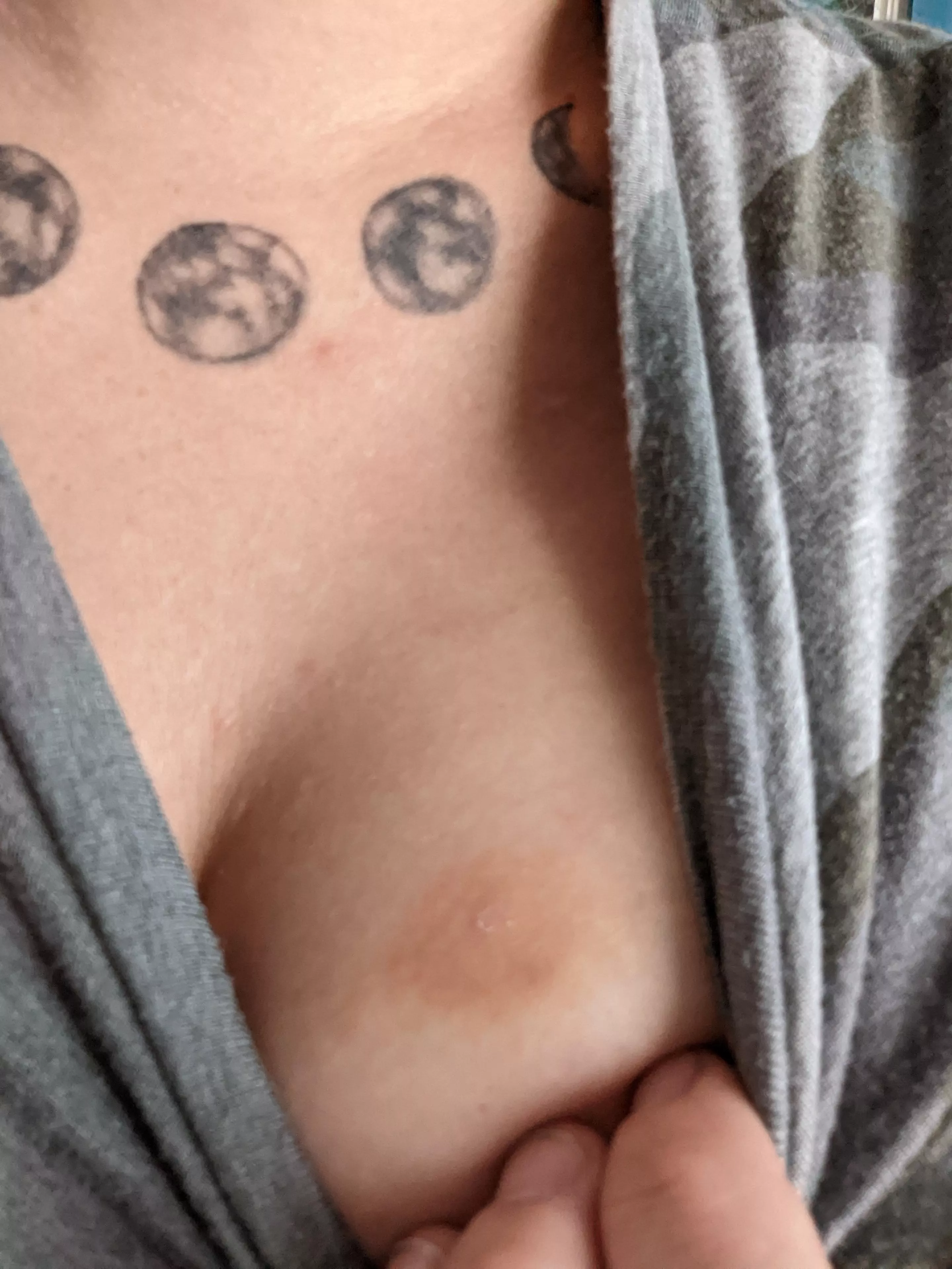 Have you ever squeezed a pimple so hard you bruised yourself? I could figure out where the bruise came from until I thought about me popping it the other day lol Have you ever squeezed a pimple so hard you bruised yourself? I could figure out where the bruise came from until I thought about me popping it the other day lol