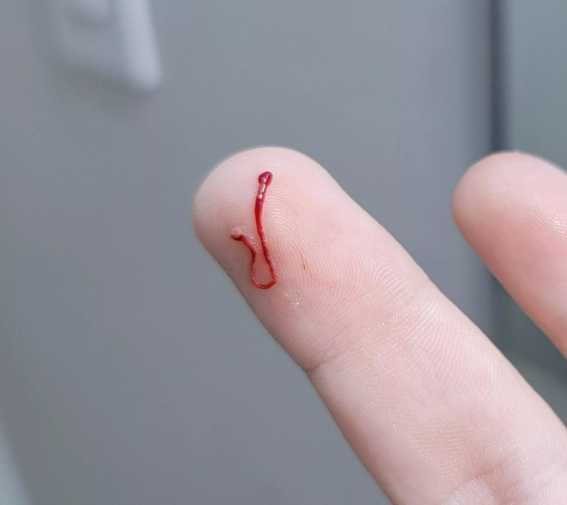 Sorry for no video, but I felt something in my throat after I got done with my ingrown toenail surgery and it turned out to be some king of blood plug thing that was hanging off like a string. Certainly felt weird to pull out! Sorry for no video, but I felt something in my throat after I got done with my ingrown toenail surgery and it turned out to be some king of blood plug thing that was hanging off like a string. Certainly felt weird to pull out!