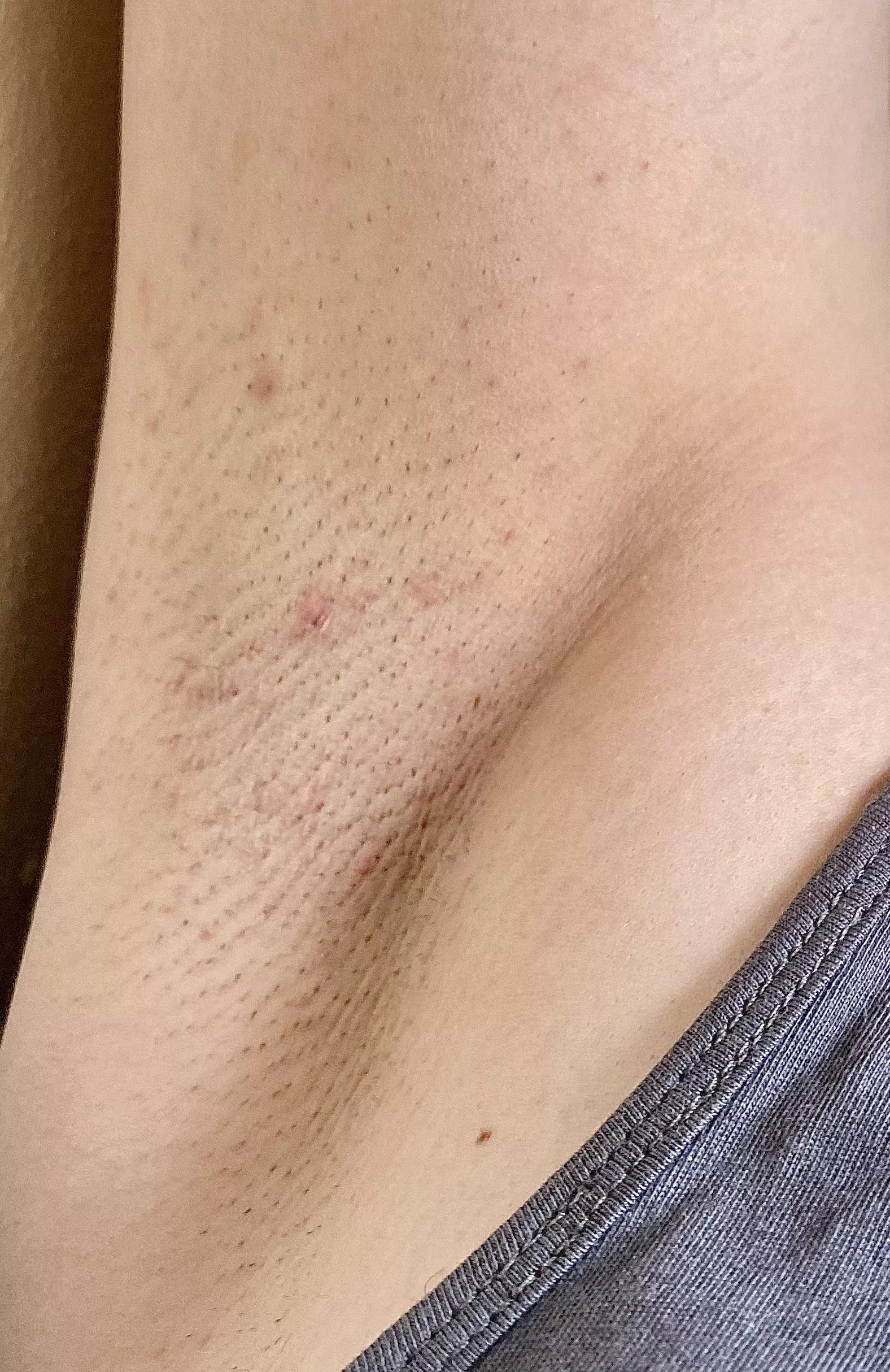 DM me freely 🥰