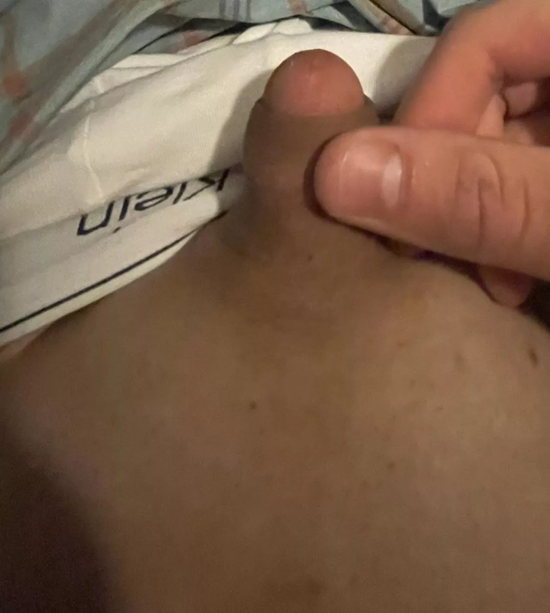 🥺