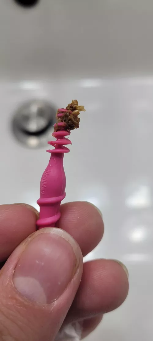 Used a NeilMed removal tool to extract this foul smelling lump of wax. The sudden regain of my hearing was heavenly