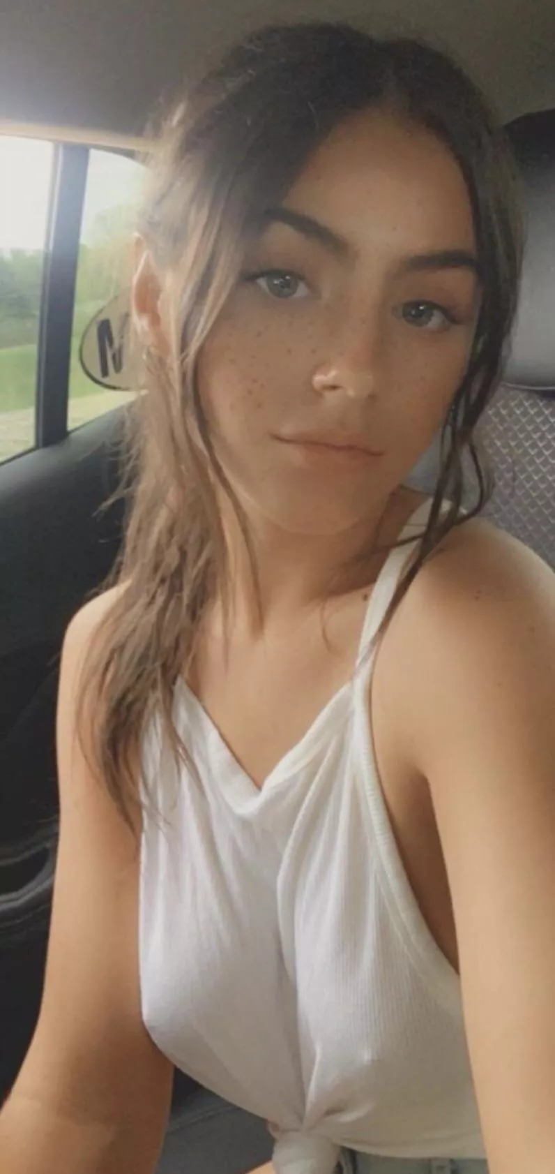Freckles