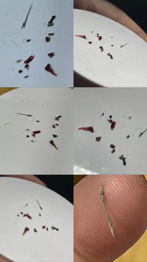 Ingrown Hairy and the Hendersons