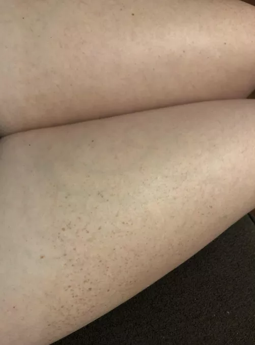 I want to go in the pool, maybe get some more freckles, maybe some tan lines