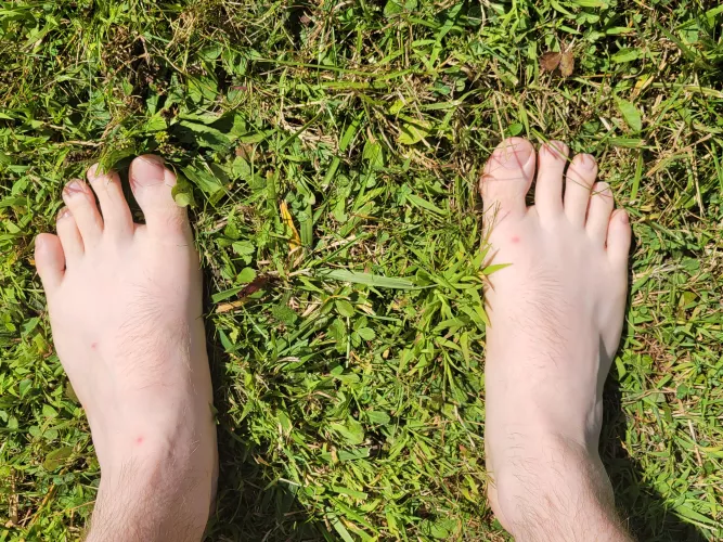 Mosquitos have attacked Master's size 15 feet. Which of you deserves the honor of rubbing lotion on them?