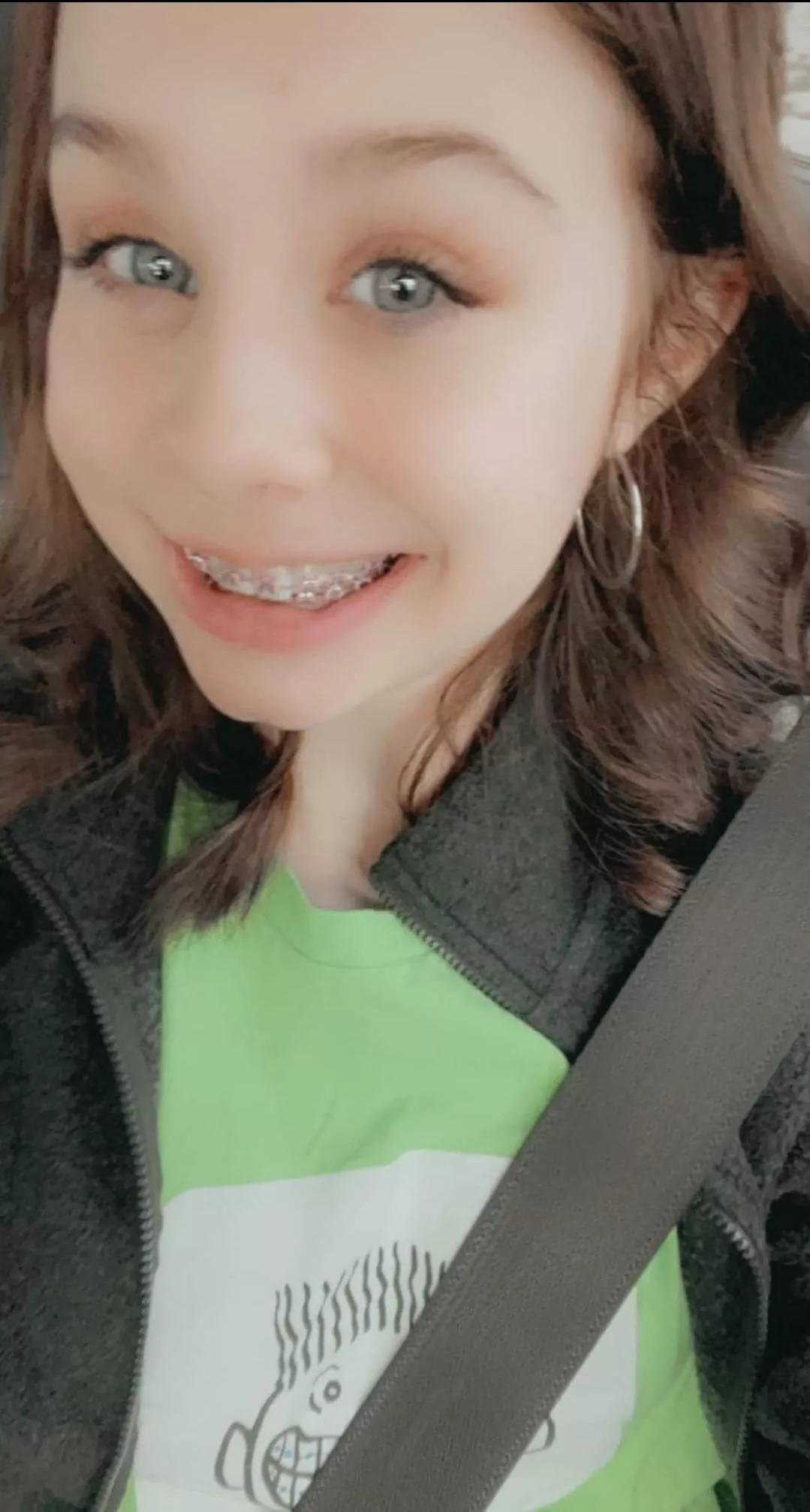 Here are my braces!