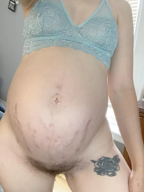 Bush or stretch marks 🤤