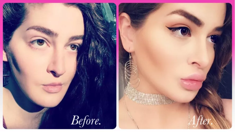 m so m6ch happier and sexier after I started changing myself to be my ideal hypersexualized dream. Look at how much bigger my cock cushions are! 