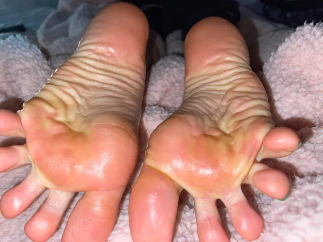 Got wrinkles?? 😘👣