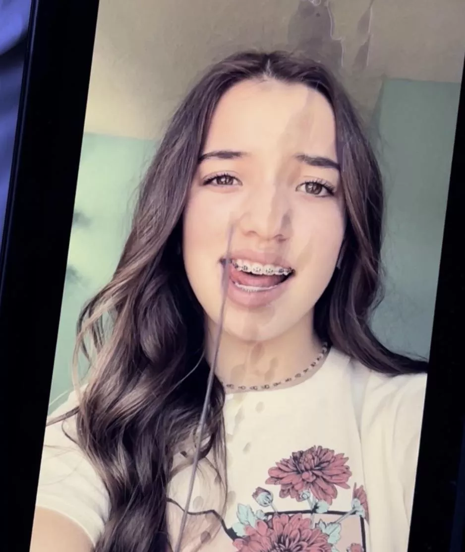 Brace face