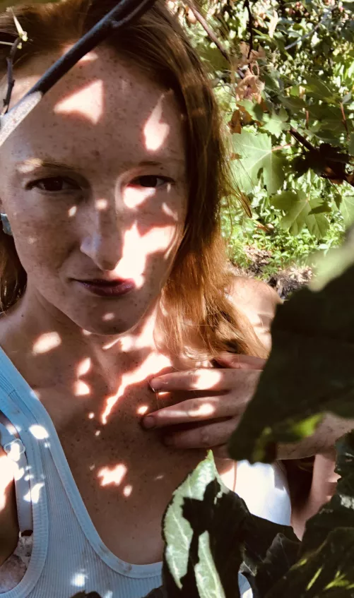 Sun Speckled Freckles