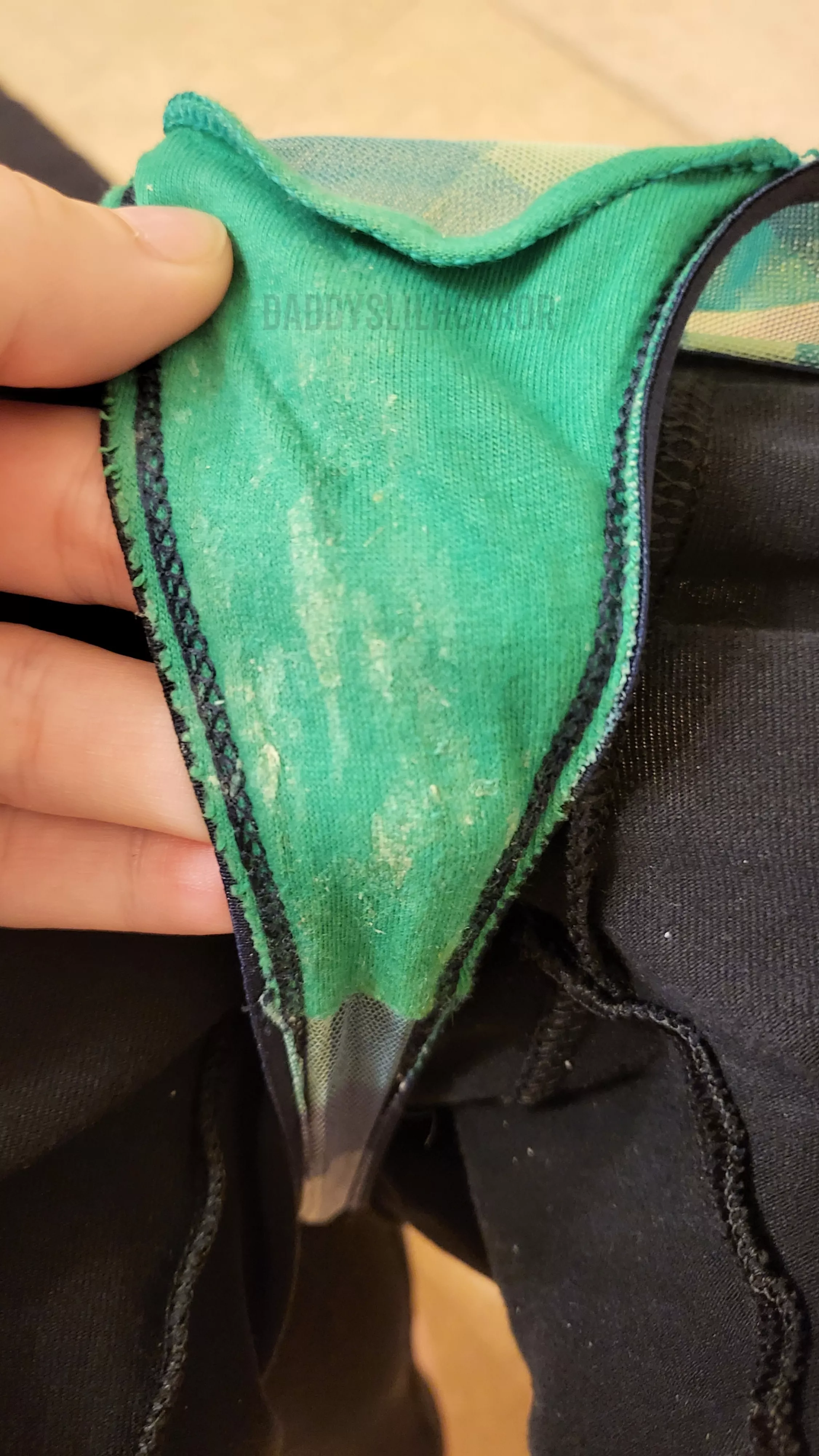 💚