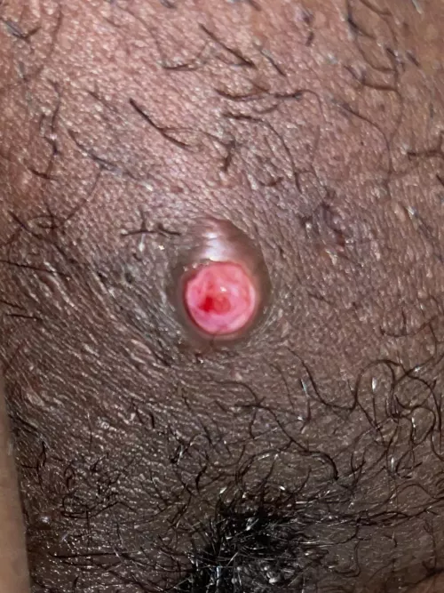 What is this? It’s super painful.