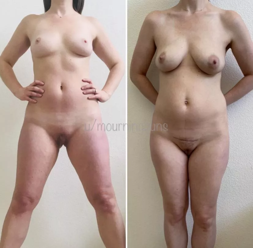 Before and After