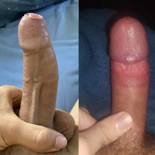 he is clearly bigger and his head is tight on the foreskin, who is the best and why?