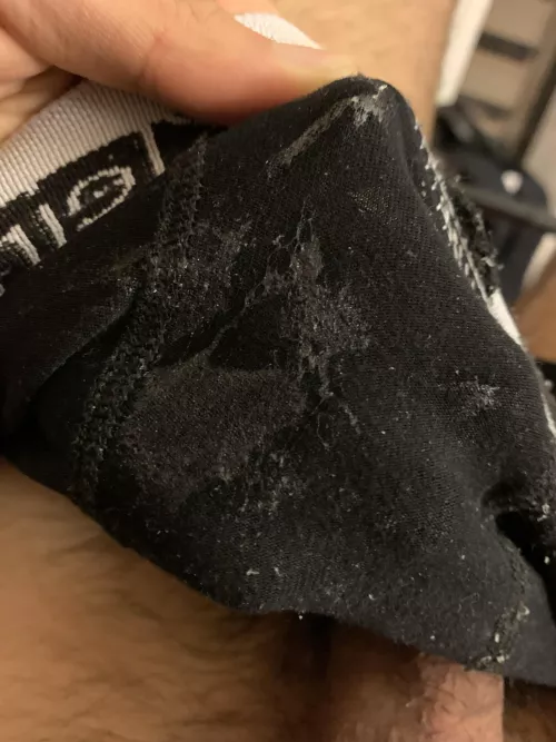 Had my first ever wet dream and woke up with my boxers looking like this.. WOW!! Is this normal??