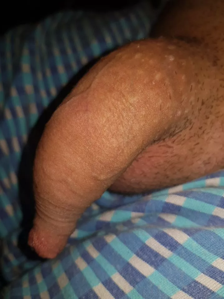 pms open