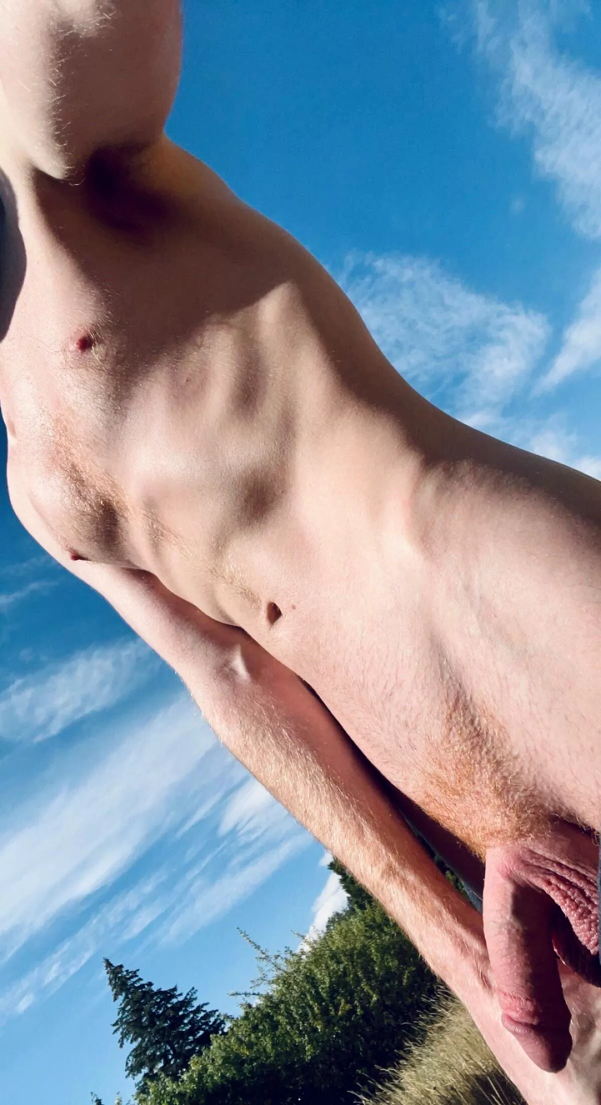 Vitamin D
