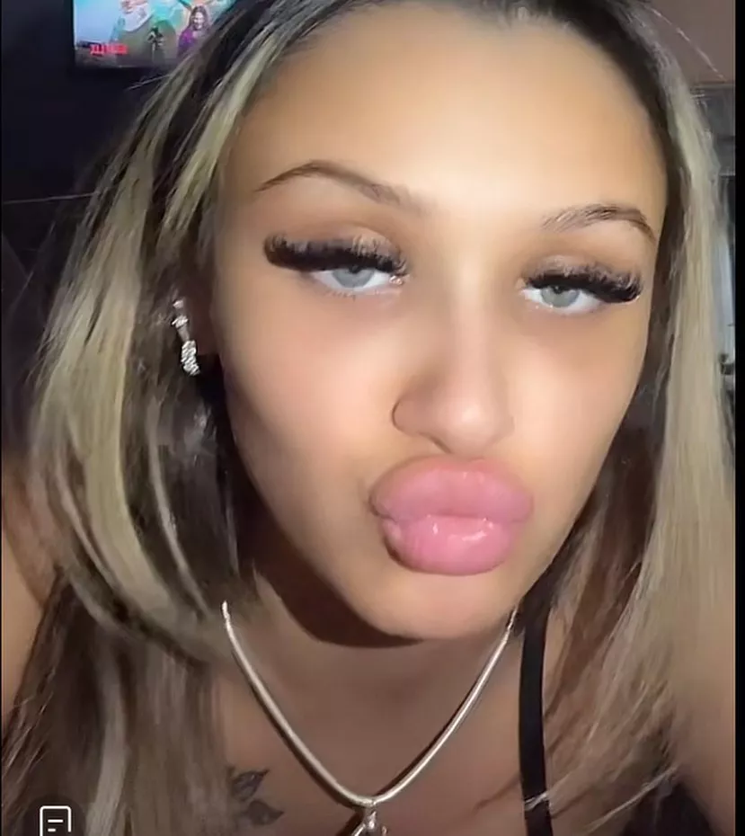 🥴🥴