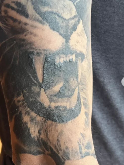 Got this tattoo around 8-9 months ago and these started appearing under the tattoo. They don’t hurt or itch, and you can pop them, but no puss come out, just a little blood if that. Any input or insight on what they are? I don’t want to pick at them 