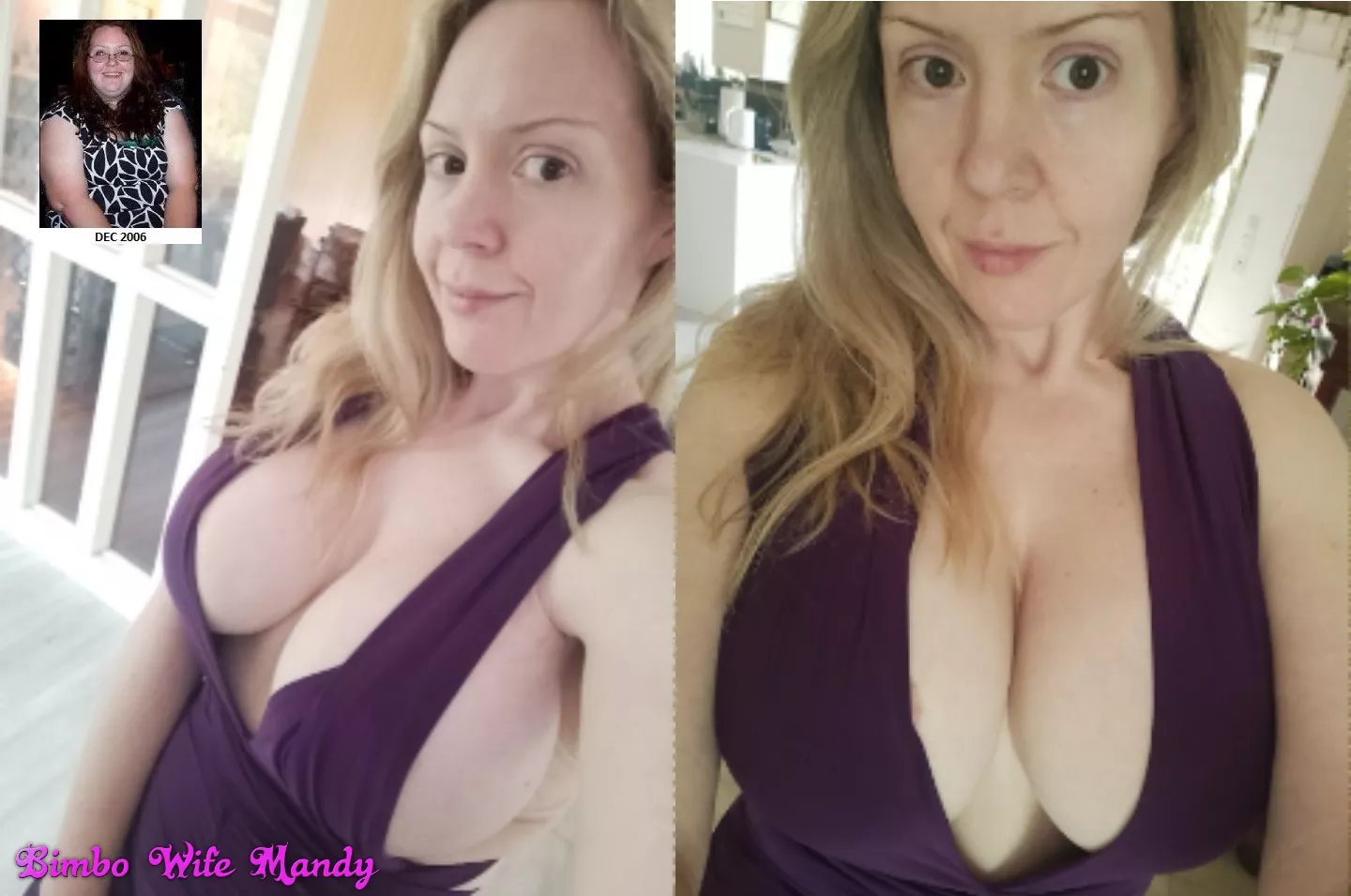 37 year old MILF Bimbo transformation (implants, lip fillers)! How am I doing? What should I do next? Do you want more? 37 year old MILF Bimbo transformation (implants, lip fillers)! How am I doing? What should I do next? Do you want more?