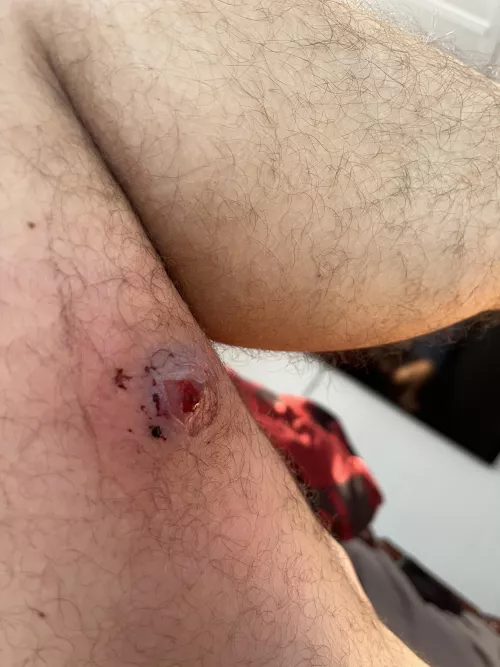 Something is Rotten in Denmark