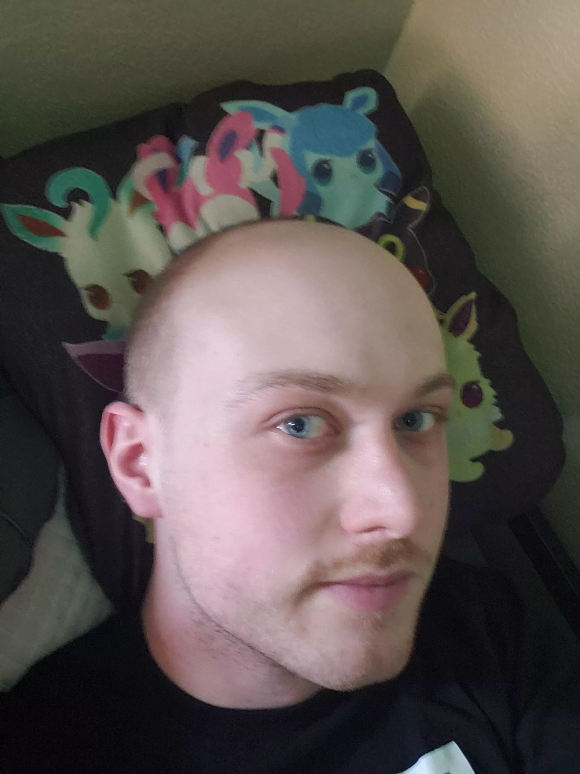 Accepted my high hairline and shaved my head. Still a bit self-conscious about my looks.