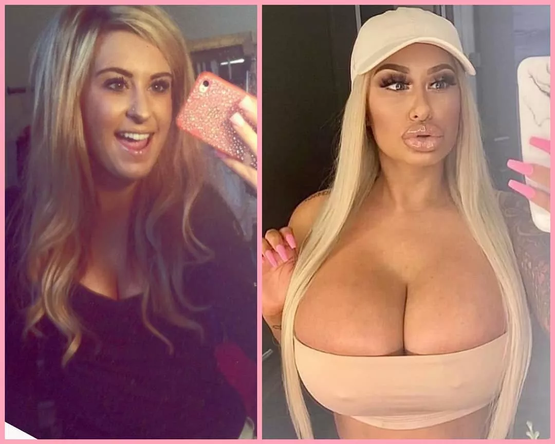 Brandi Bae