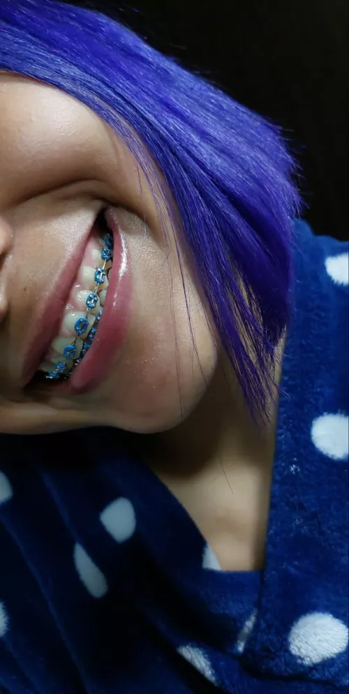 Can you leave your love in my braces? 💦