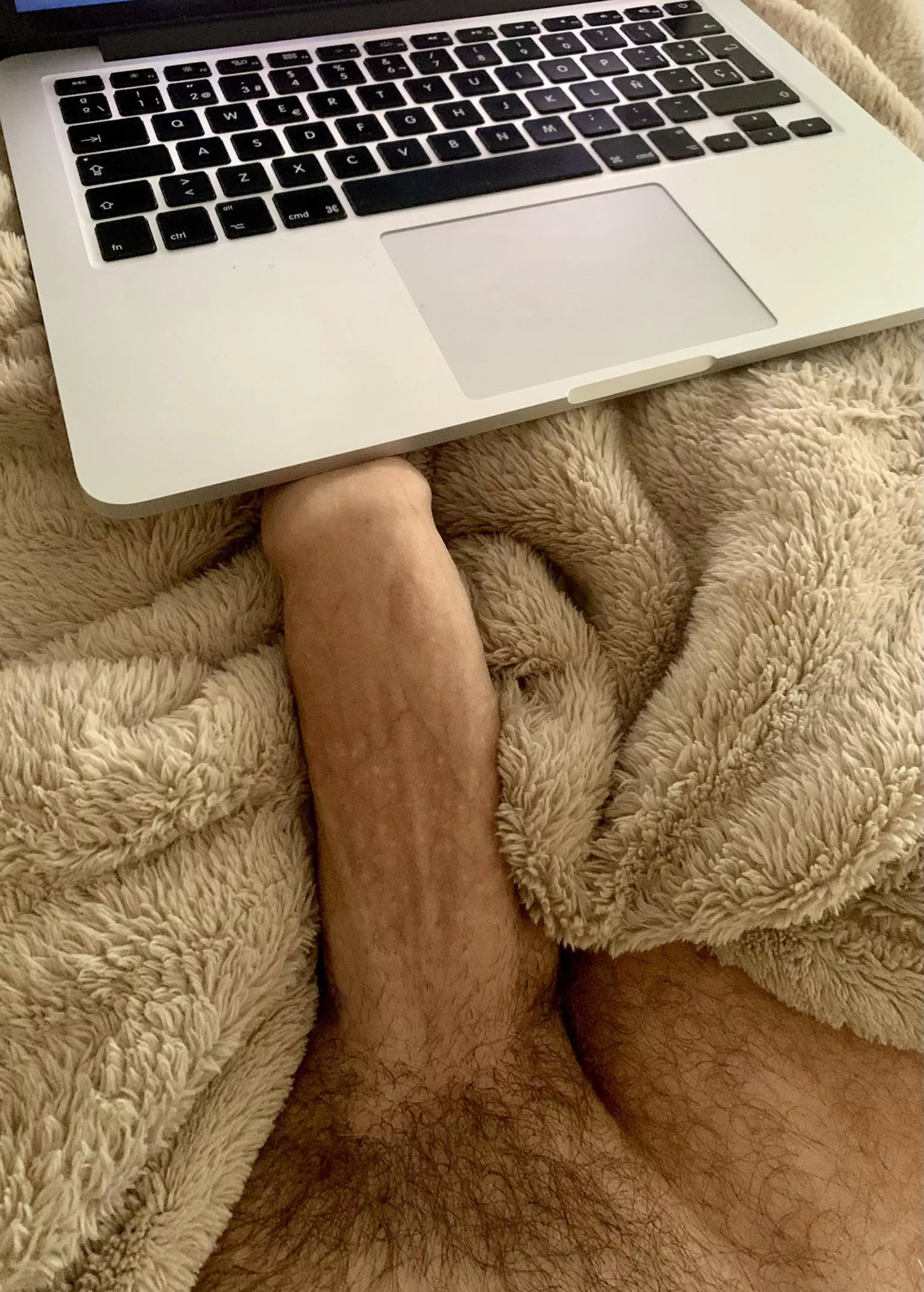 💻