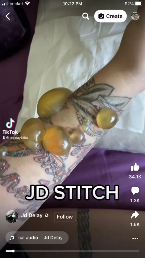 Mother of mrsa! Saw this on Tiktoc. Was one of those split videos.