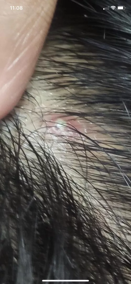 Found this pic on another subreddit, dear god I would pay money to pluck that hair and watch the goop come out …