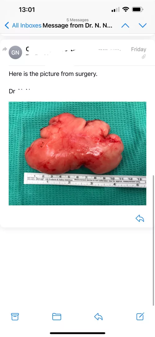 I see your arm relief and raise you my hip “bump”…