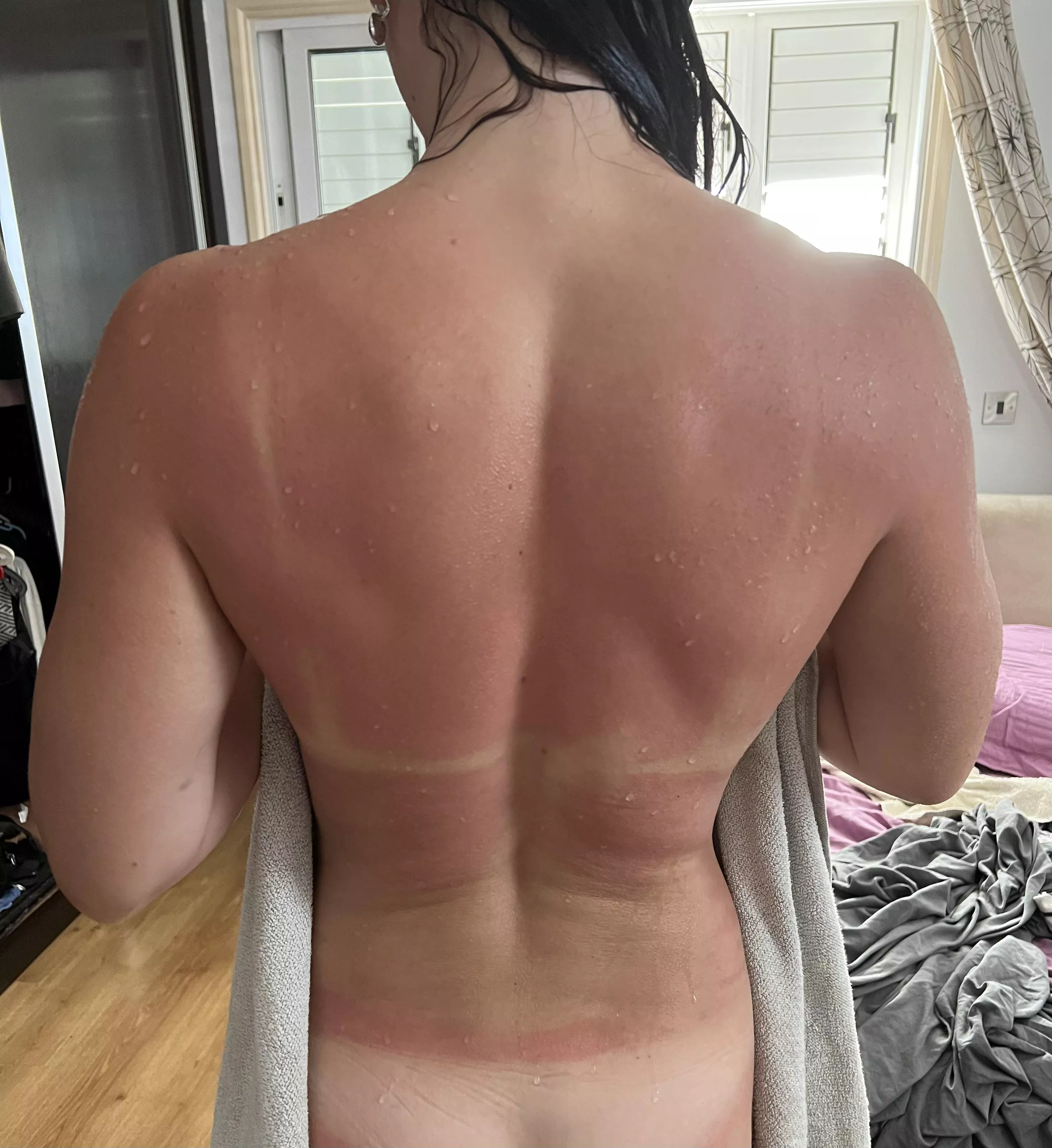 Went for tanlines, came out burnt 😬