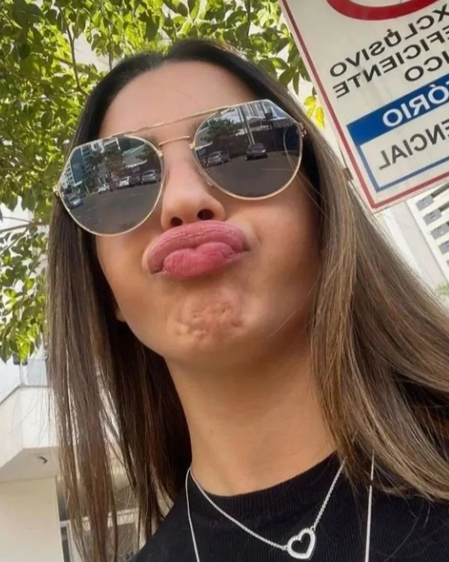 💋🕶