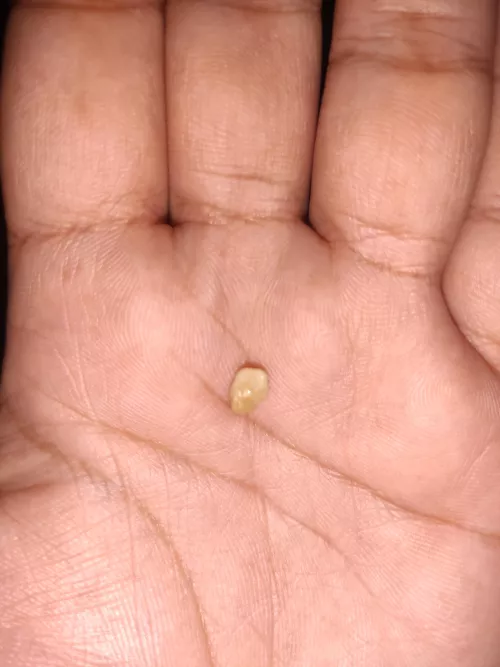 The biggest one I have coughed out in recent times [OC]