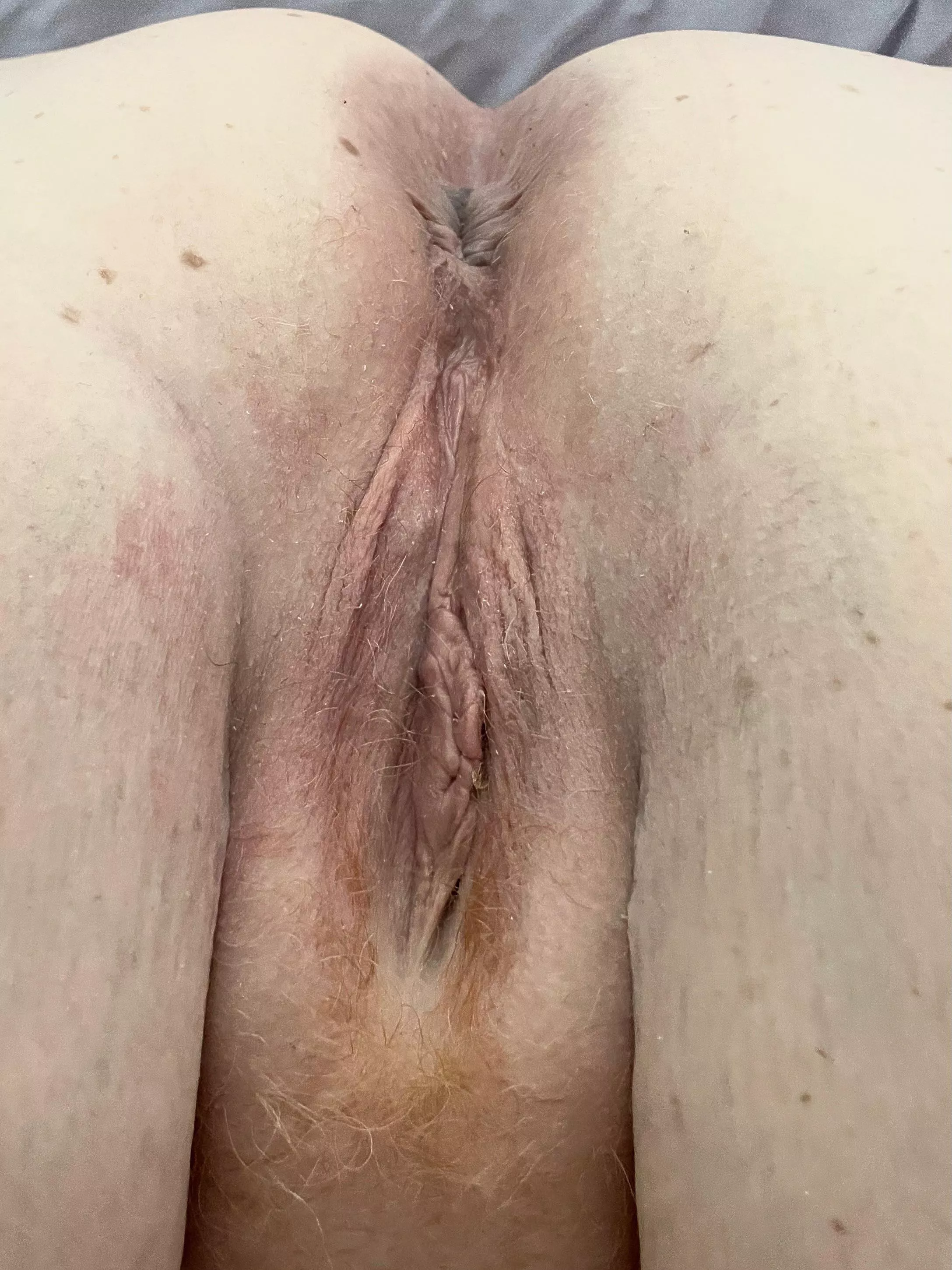 Chose a hole