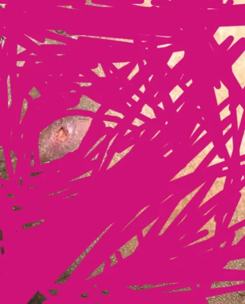 What is happening?? boil popped on its own and it went down and then a red bump popped up on the healed scar and then this happened? this was also on my inner thigh near private area where it rubbed constantly against my skin. I'm going to get me an app