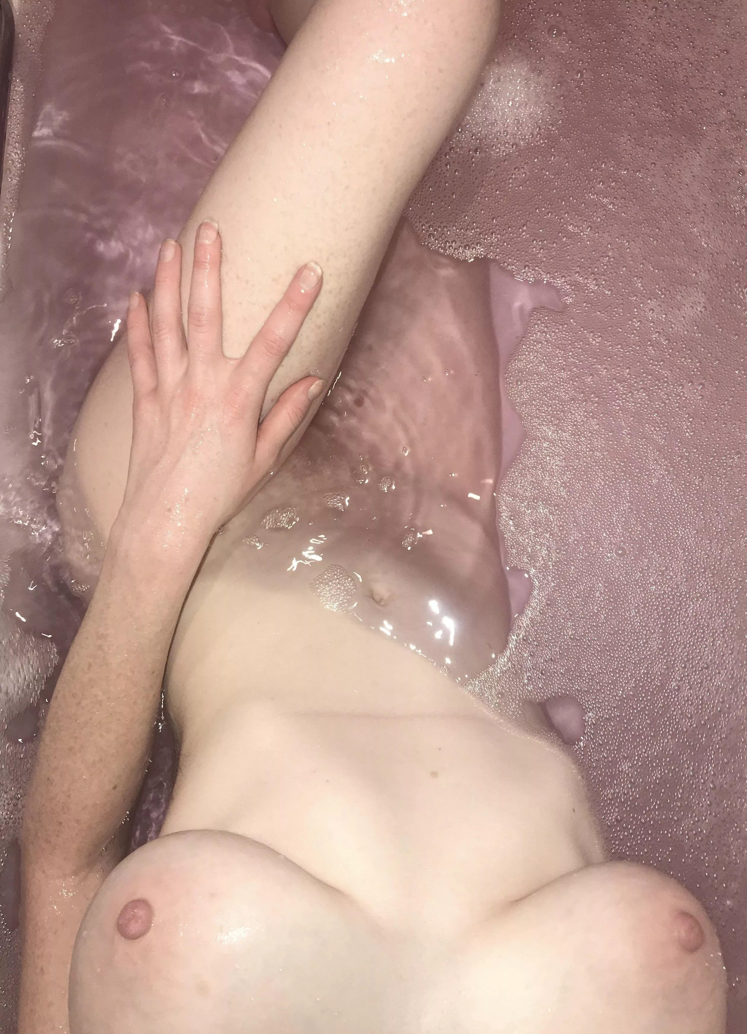 F/19/5β2/110lbs Always hated the scar across my tummy from a previous surgery, but itβs part of me π€ F/19/5β2/110lbs Always hated the scar across my tummy from a previous surgery, but itβs part of me π€