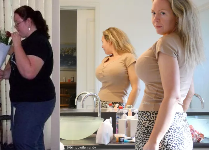 My (37F) bimbofication journey - Weight loss, 1650cc breast implants, lip fillers, etc - I think my body line is looking pretty good these days?