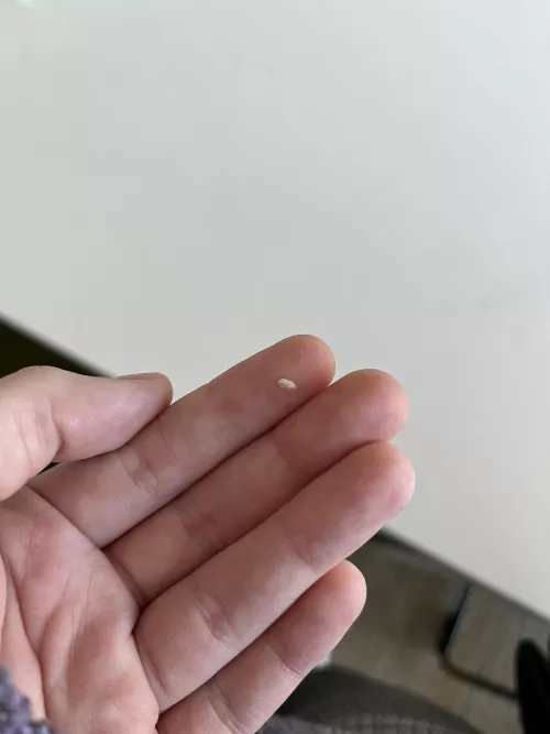 got wisdom teeth out a few months ago, and there’s been a shard of bone poking through my gum for AGES. it finally came out!!