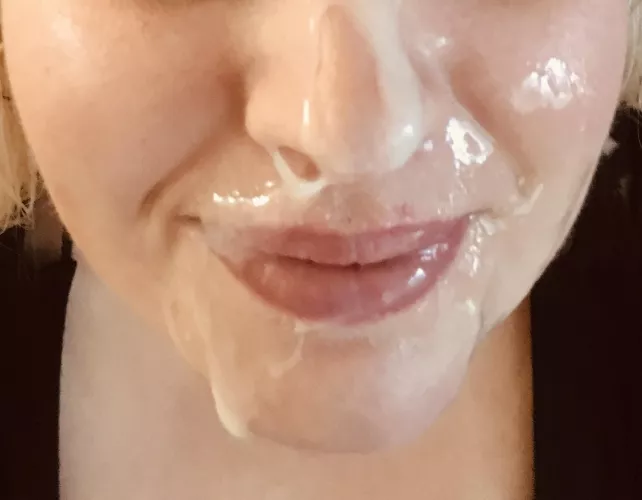 My face getting sown like a meadow 😂