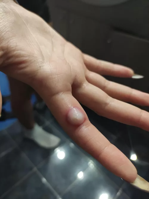 On my sister hand, I want to pop It so much but she doesn't let me...