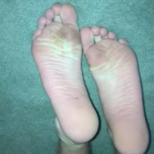 20 they need a cleaning