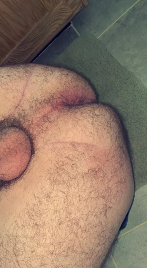 23 Hairy bottom - DM’s open